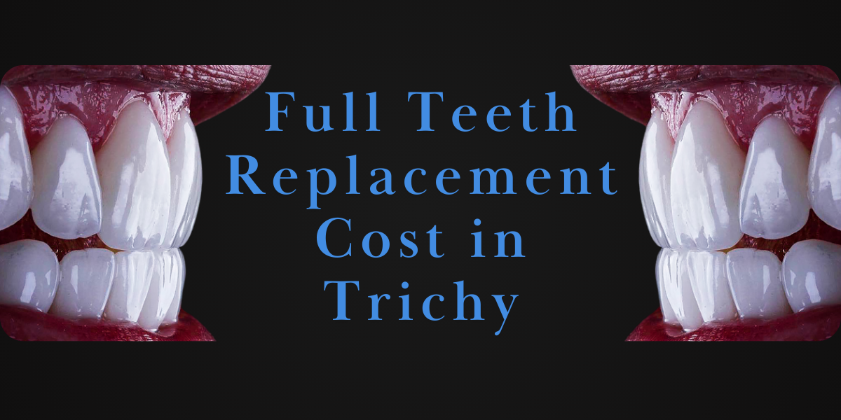 Full Teeth Replacement